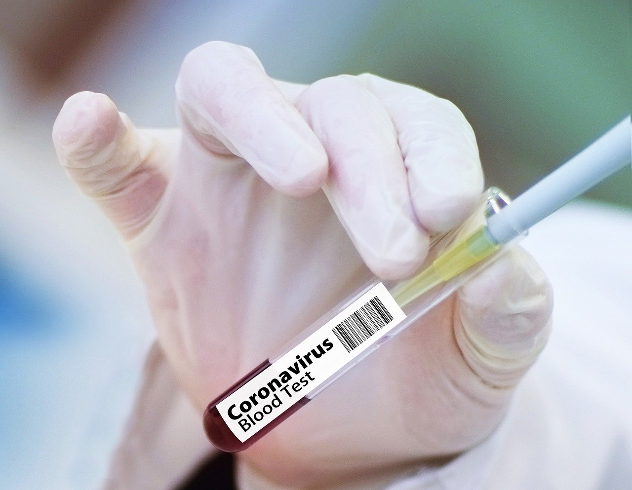 В Белгородской области подтвердился новый случай заражения коронавирусом