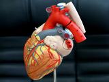 Как делают операции на сердце в белгородском кардиологическом центре - Изображение 10