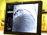 Как делают операции на сердце в белгородском кардиологическом центре - Изображение 13
