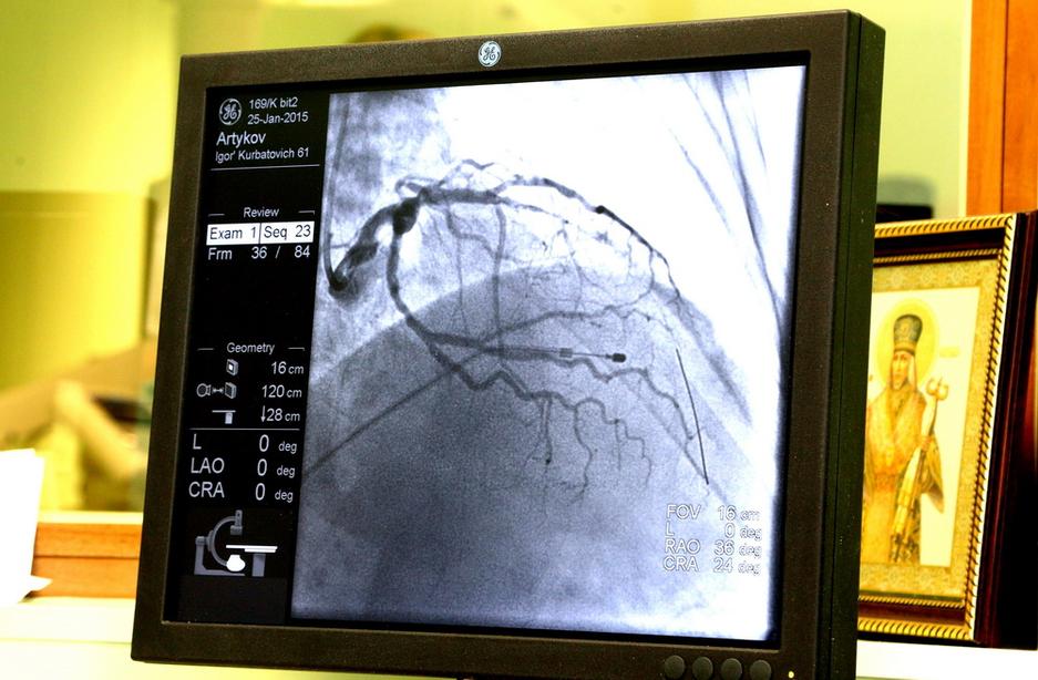 Как делают операции на сердце в белгородском кардиологическом центре - Изображение 13