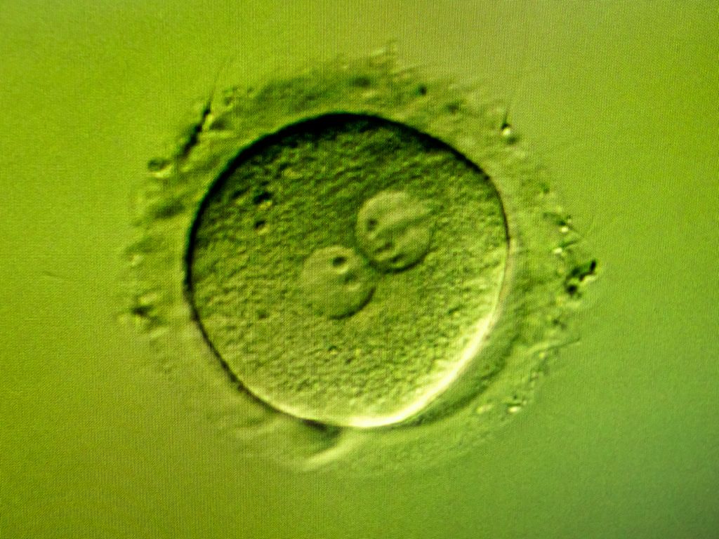 Оплодотворённая яйцеклетка с двумя ядрами: мужским и женским