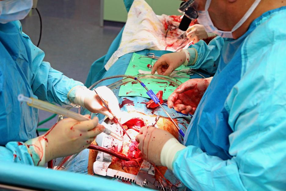 Как делают операции на сердце в белгородском кардиологическом центре - Изображение 3