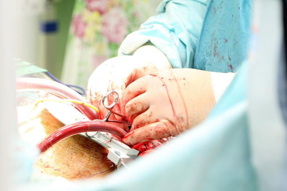 Как делают операции на сердце в белгородском кардиологическом центре - Изображение 6