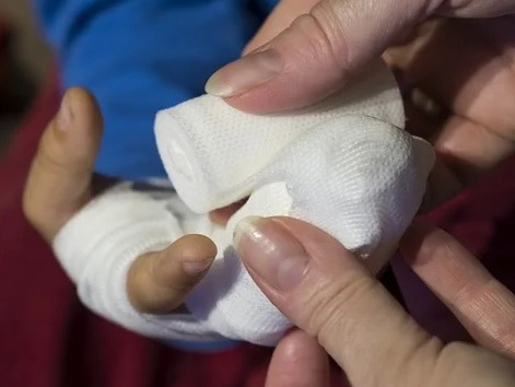 Травматологи Белгородской областной больницы принимают за смену около 100 детей